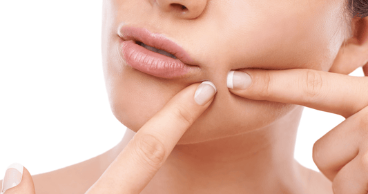 What to Do After Popping a Pimple: 7 Scientific Methods for You